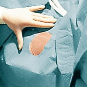 Σετ καισαρικής τομής ΙΙ Foliodrape Protect 2 στρώσεων (4άδα)