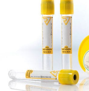 ΣΩΛHNAΡΙΑ με επιταχυντή πήξης SST Gel+Clot 5ml (ΚΙΤΡΙΝΑ)