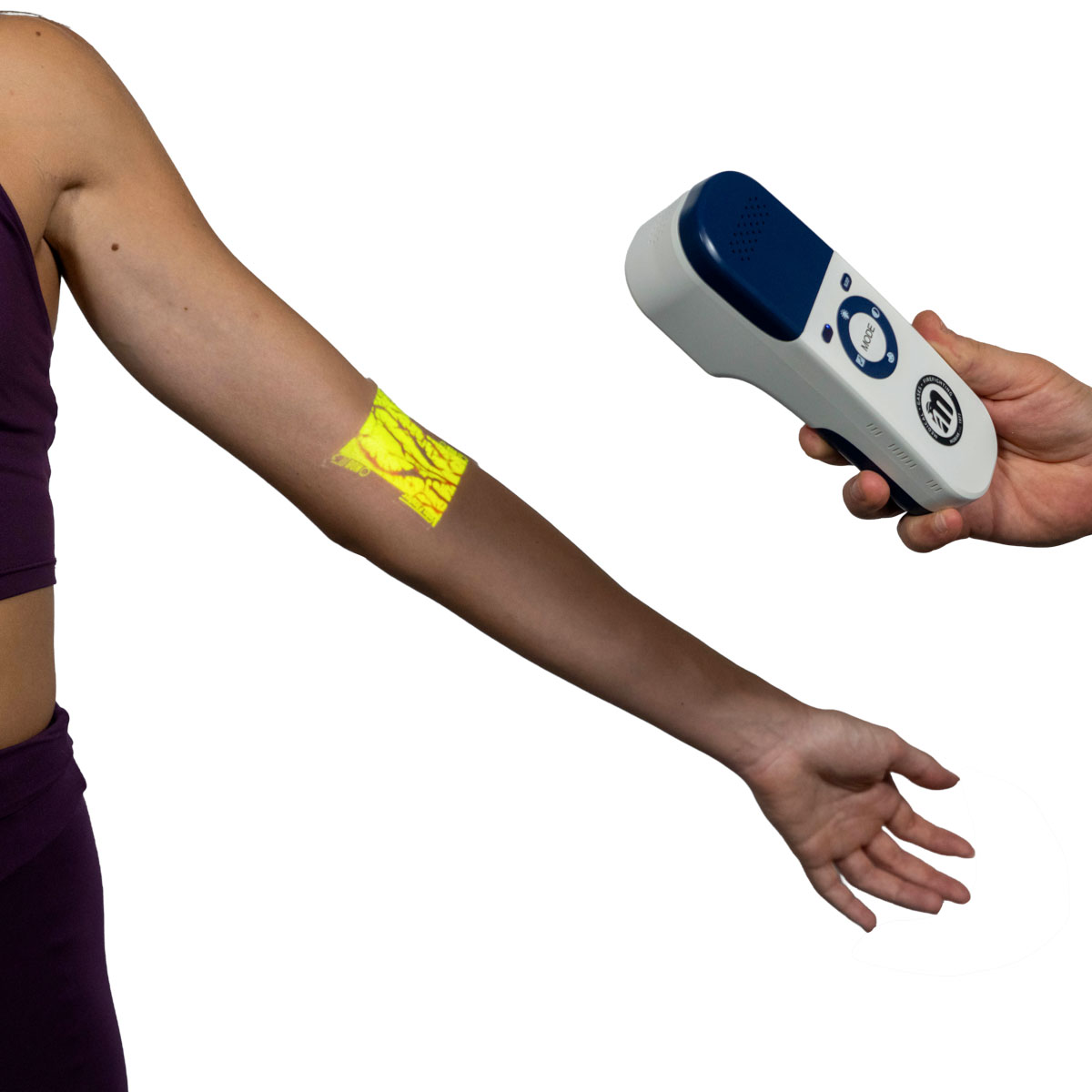 Arm extended to the side with a neon yellow adhesive patch on the forearm being scanned by a handheld therapy device