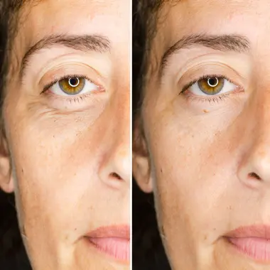 Ορος για Μαυρους Κυκλους MAGIC SERUM CAMALEON - Image 3